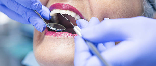 Best Emergency Dental Care for Broken or Chipped Teeth in Big Lake, MN
